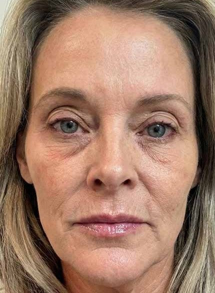 I finally found a cream my skin actually responds to
