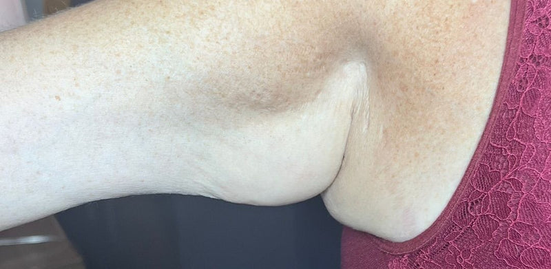 After 8 weeks