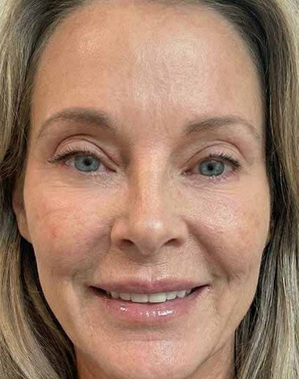 I finally found a cream my skin actually responds to