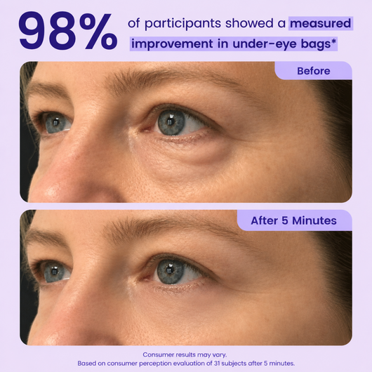 Instant Lifting Eye Gel