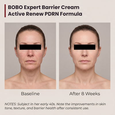 Time Reverse Madeca Cream — Advanced PDRN Formula
