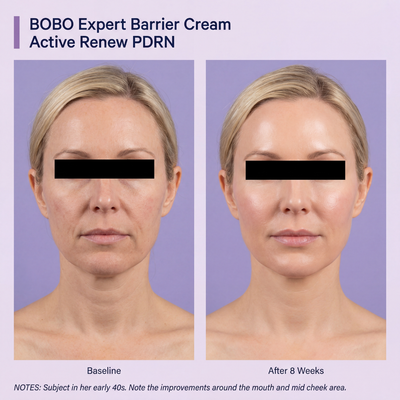 Firming Expert Madeca Cream — Advanced PDRN Formula
