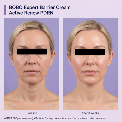 Firming Expert Madeca Cream — Advanced PDRN Formula