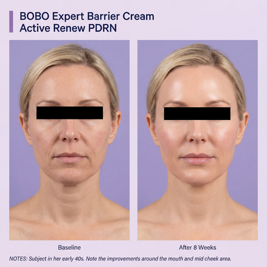 Firming Expert Madeca Cream — Advanced PDRN Formula
